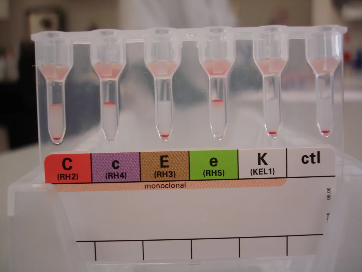 Laboratory gel card for extended Rh and Kell blood typing, with a blood sample in each labelled column